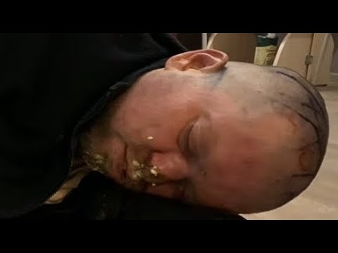 Wooden Skessa's Live broadcast