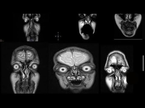 СЮРСТРИМИНГ